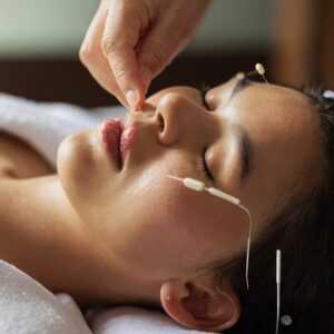 Debunking Myths About Acupuncture: Acupuncture treatment for relaxation and stress relief. Debunking myths about acupuncture and exploring its holistic benefits.
